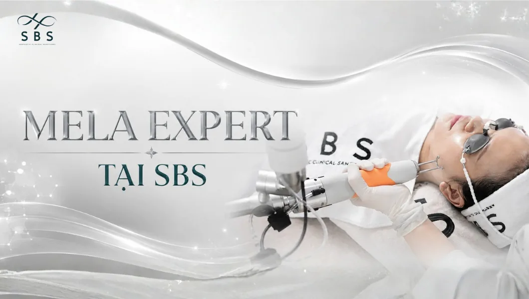 Mela Expert
